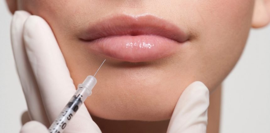 botox-lips
