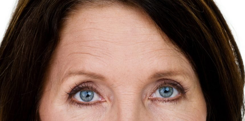 woman-wrinkles